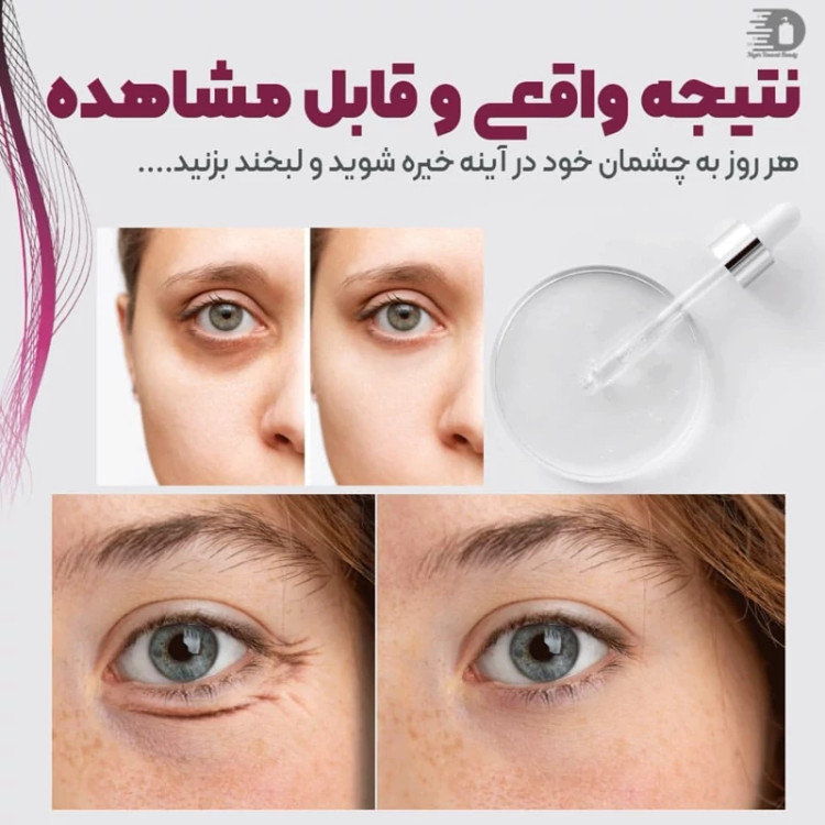 سرم دور چشم گنوسی (مناسب برای تیرگی ،پف و چروک) سه در یک 30میل